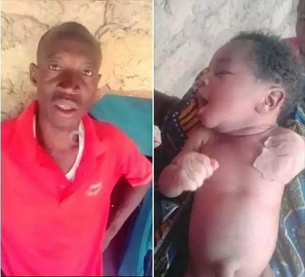 Doctor Amputates the Hand of a Baby Thought to Have Died In The Womb Only to Discover the Baby Is Alive (Photos)